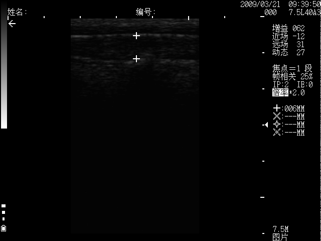 RKU10 Veterinary  B mode ultrasound scanner