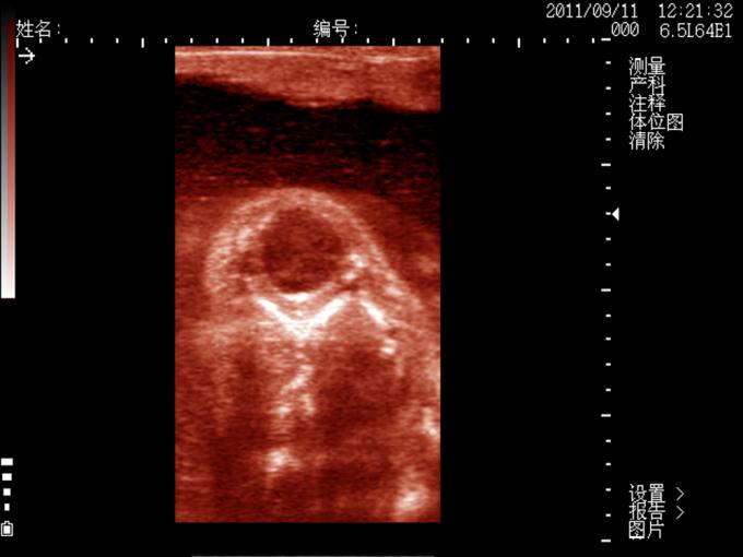 KX5200 Veterinary B Mode Ultrasound scanner