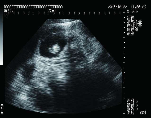 MSU1 PLUS mechanical sector ultrasound scanner (Updated)