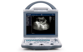 KX5600 Full digital B mode ultrasonic diagnostic instruments