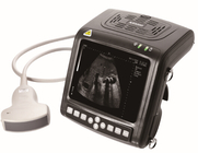 KX5200 full- digital B mode human dianostic ultrasound scanner