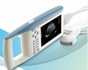 KX5100 portable full- digital B mode human ultrasound scanner
