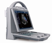DCU12 portable full digital color doppler ultrasound scanner(Updated version)