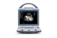 KX5600 Full digital B mode ultrasonic diagnostic instruments
