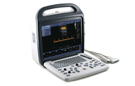 DCU10 Digital Color Doppler Ultrasonic Diagnostic Instrument