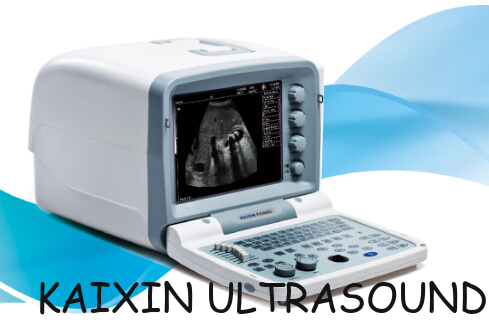 KX2000G portable B mode human ultrasound scanner