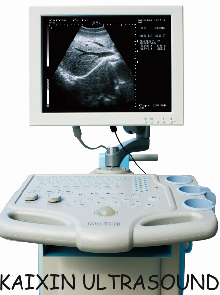 Trolly human B mode ultrasonic diagnostic instruments