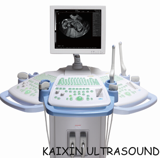 KX2805 trolly human ultrasonic diagnostic instruments