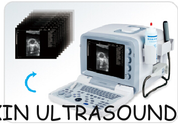 KX2000V portable full digital B mode veterinary diagnostic ultrasound scanner