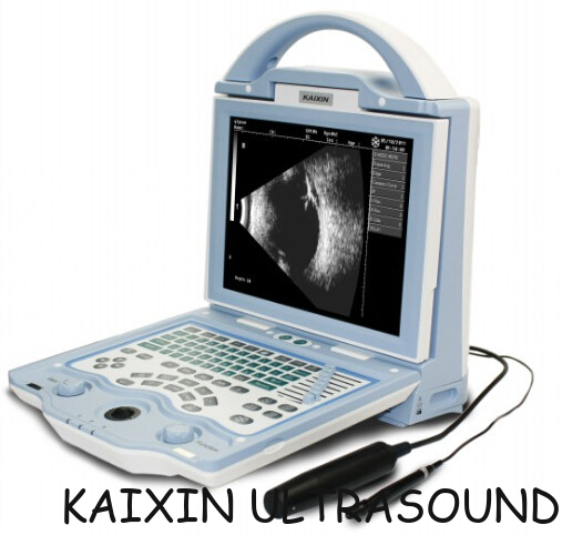 ODU5 ophthalmonic A/B ultrasound scanner