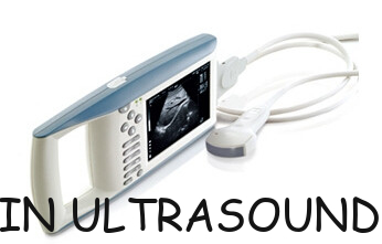 KX5100 B/W system hand-held ultrasonic diagnostic instruments