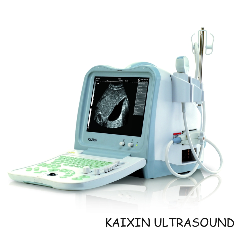 KX2600V portable  veterinary ultrasound scanner