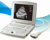 KX5000 laptop ultrasound scanner for human