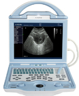KX5600 portable human ultrasound scanner