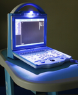 KX5600 portable ultrasound scanner