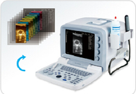 KX2000V Full digital B mode ultrasonic diagnostic instruments