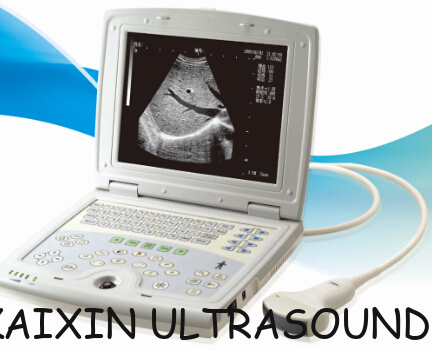 KX5000 laptop human ultrasound scanner