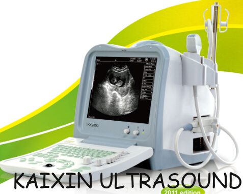 KX2600 portable full digital B mode human ultrasound scanner