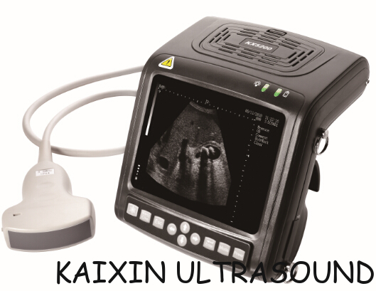 KX5200 human ultrasound scanner