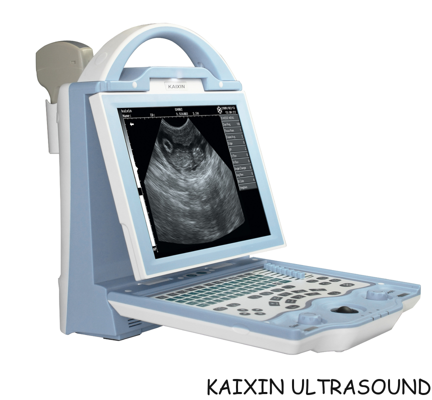 KX5600V portable  veterinary ultrasound scanner