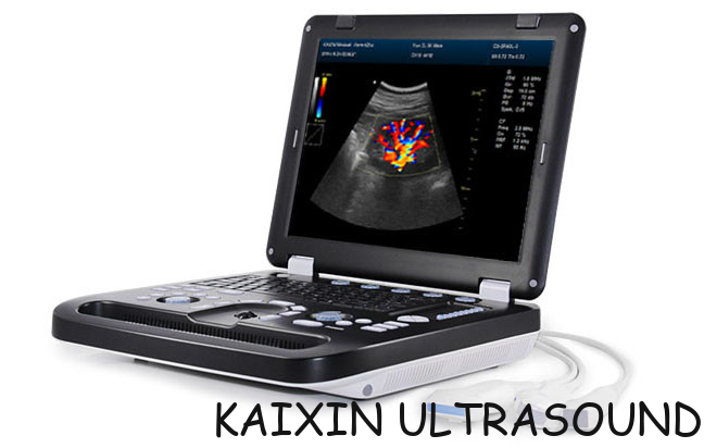 DCU30 Full Digital Color Doppler Ultrasonic Diagnostic Instruments